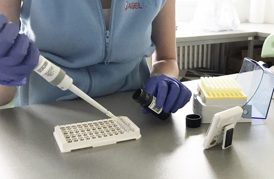 Spalničky - Laboratoře AGELLAB nabízejí testování na přítomnost protilátek