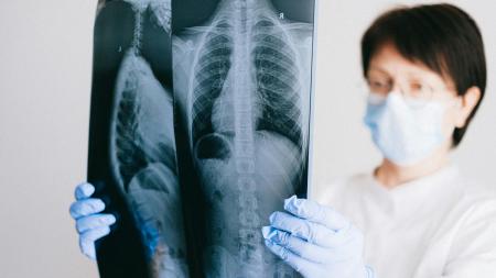 Radiologická ambulance v Kraslicích nezanikne: Získala dotaci od Karlovarského kraje