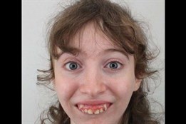 Mentálně postižená Petra (24) se ztratila při houbaření. Pátrají po...